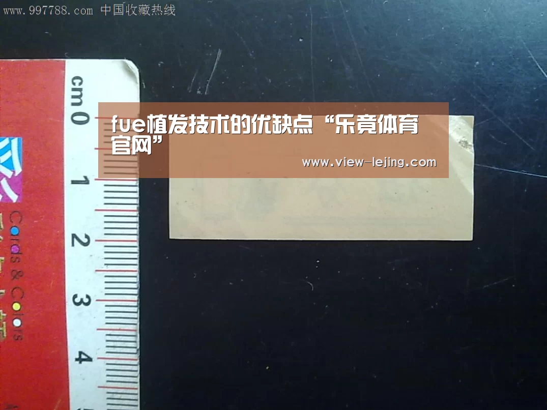 
fue植发技术的优缺点“乐竟体育官网”